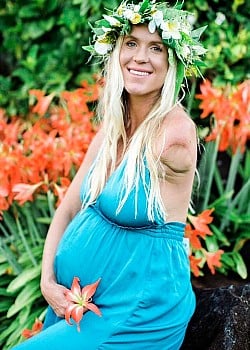 Bethany Hamilton image 3 of 3