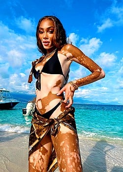 Winnie Harlow image 4 of 4