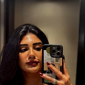 Supritha Naidu