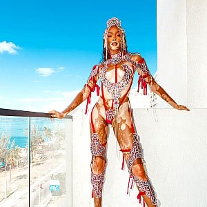 Winnie Harlow