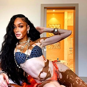 Winnie Harlow