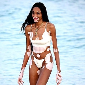 Winnie Harlow